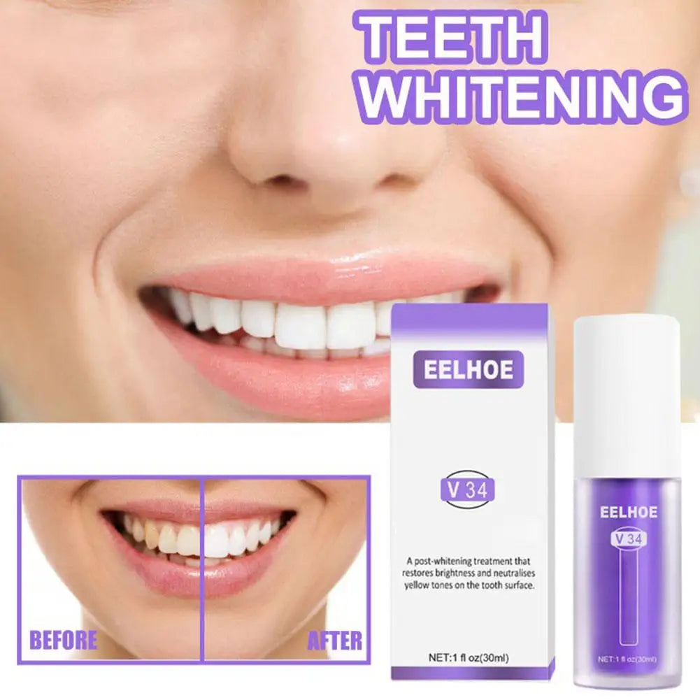 ✨Last Day Promotio🎁Purple Teeth Whitening Pro