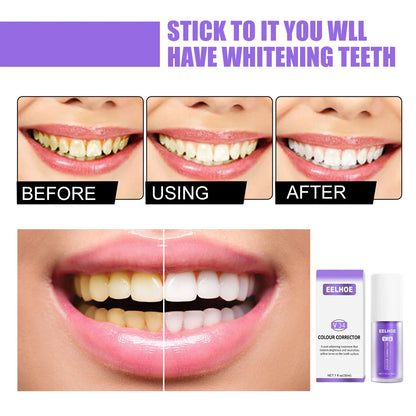 ✨Last Day Promotio🎁Purple Teeth Whitening Pro